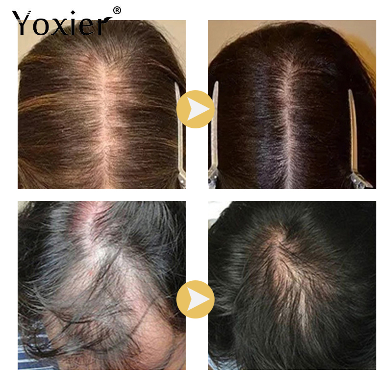 Сыворотка для интенсивного рос – обзор и цена Hair Care Hair Serum